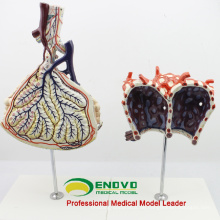 Lung07 (12504) Anatomisches Modell des Menschen Lobulus und Alveole der Lunge, Anatomie Modelle&gt; Atmung